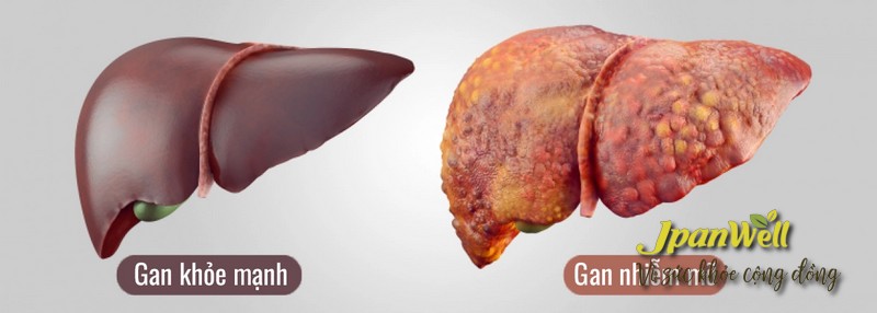 Công dụng chính của Dr. Liver (dạng nước) là giảm mỡ trong gan